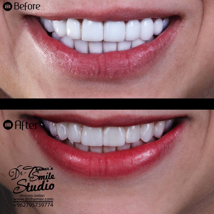 Dr. Thamer’s Smile Studio Dental Clinics - Dr. Thamer’s Smile Studio Dental Clinics