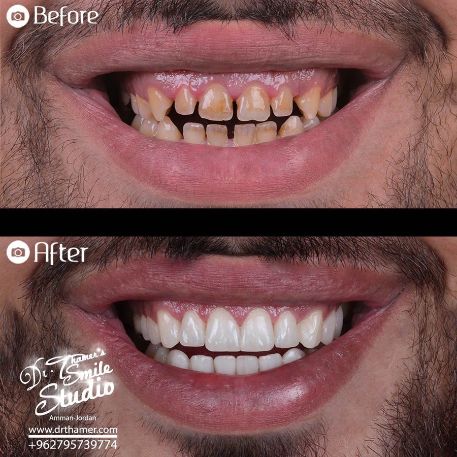 Dr. Thamer’s Smile Studio Dental Clinics - Dr. Thamer’s Smile Studio Dental Clinics