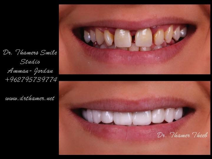 Dr. Thamer’s Smile Studio Dental Clinics - Dr. Thamer’s Smile Studio Dental Clinics