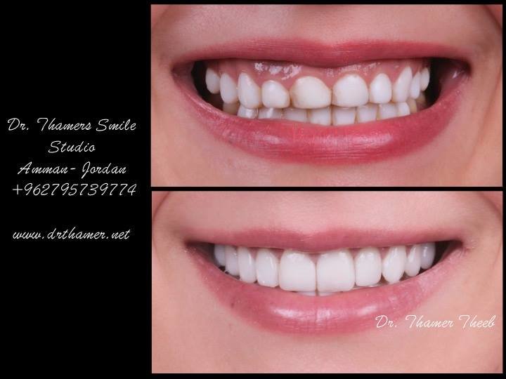 Dr. Thamer’s Smile Studio Dental Clinics - Dr. Thamer’s Smile Studio Dental Clinics