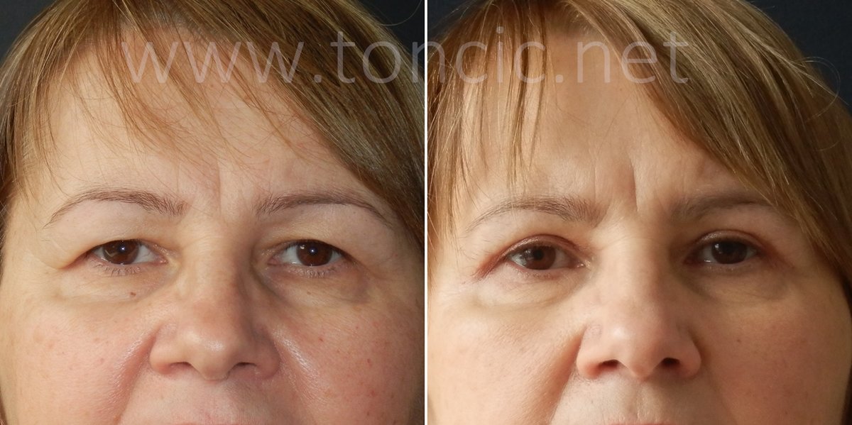 Dr Toncic - Cosmetic Surgery - Dr Toncic - Cosmetic Surgery