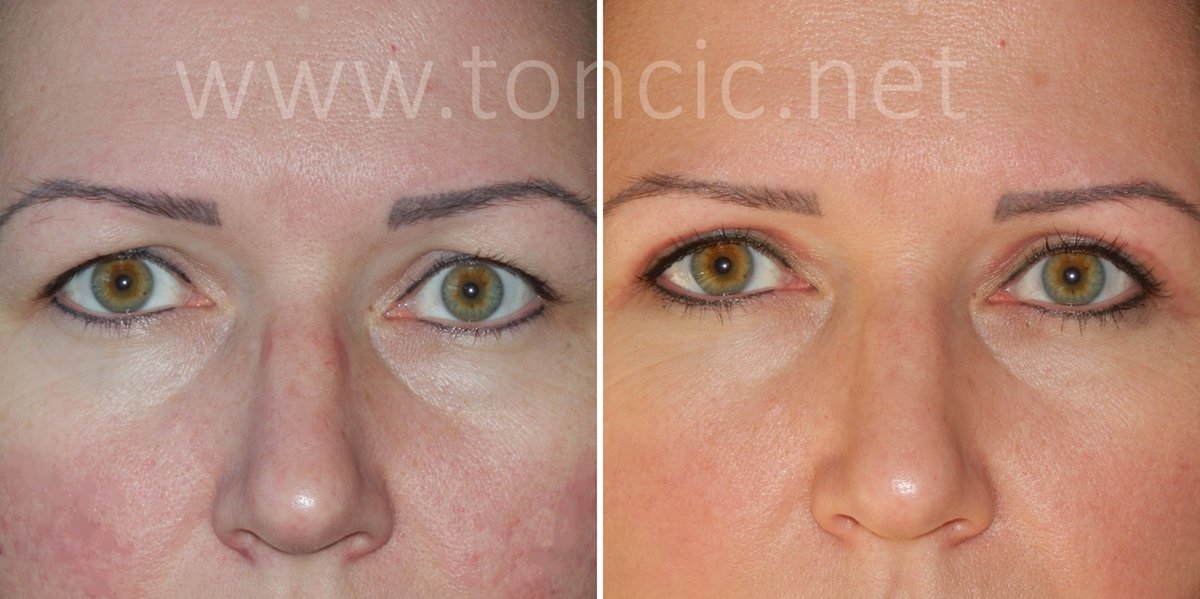 Dr Toncic - Cosmetic Surgery - Dr Toncic - Cosmetic Surgery