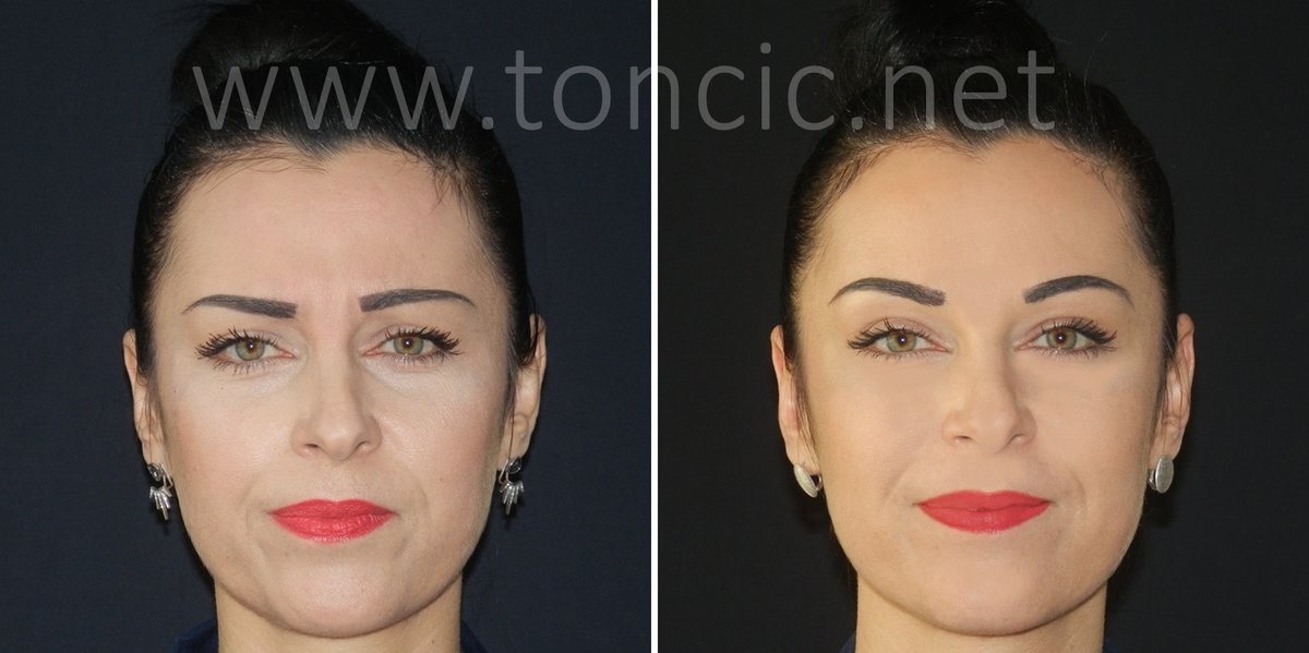 Dr Toncic - Cosmetic Surgery - Dr Toncic - Cosmetic Surgery