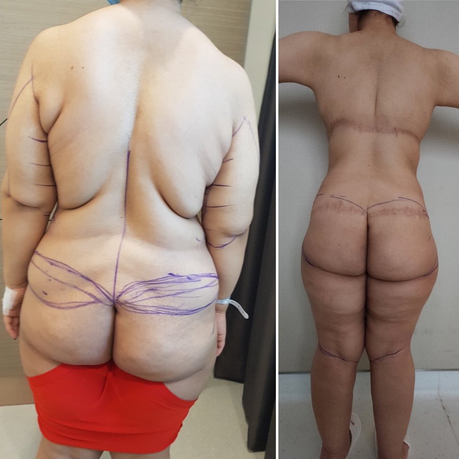 Dr. Turker Ozyigit - Dr. Turker Ozyigit