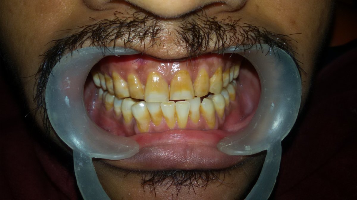 Dr Vaibhav Kumar's Dental Clinic - Dr Vaibhav Kumar's Dental Clinic