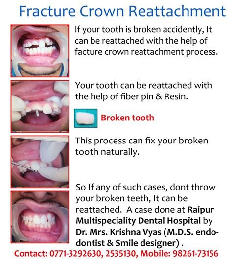 Dr. Vyas Raipur Multispeciality Dental Hospital - Dr. Vyas Raipur Multispeciality Dental Hospital