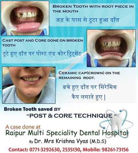 Dr. Vyas Raipur Multispeciality Dental Hospital - Dr. Vyas Raipur Multispeciality Dental Hospital
