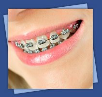 Dr. Wiley - PWP Orthodontics - Dr. Wiley - PWP Orthodontics