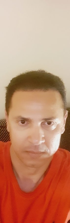 Dr. Yetkin BAYER - Dr. Yetkin BAYER