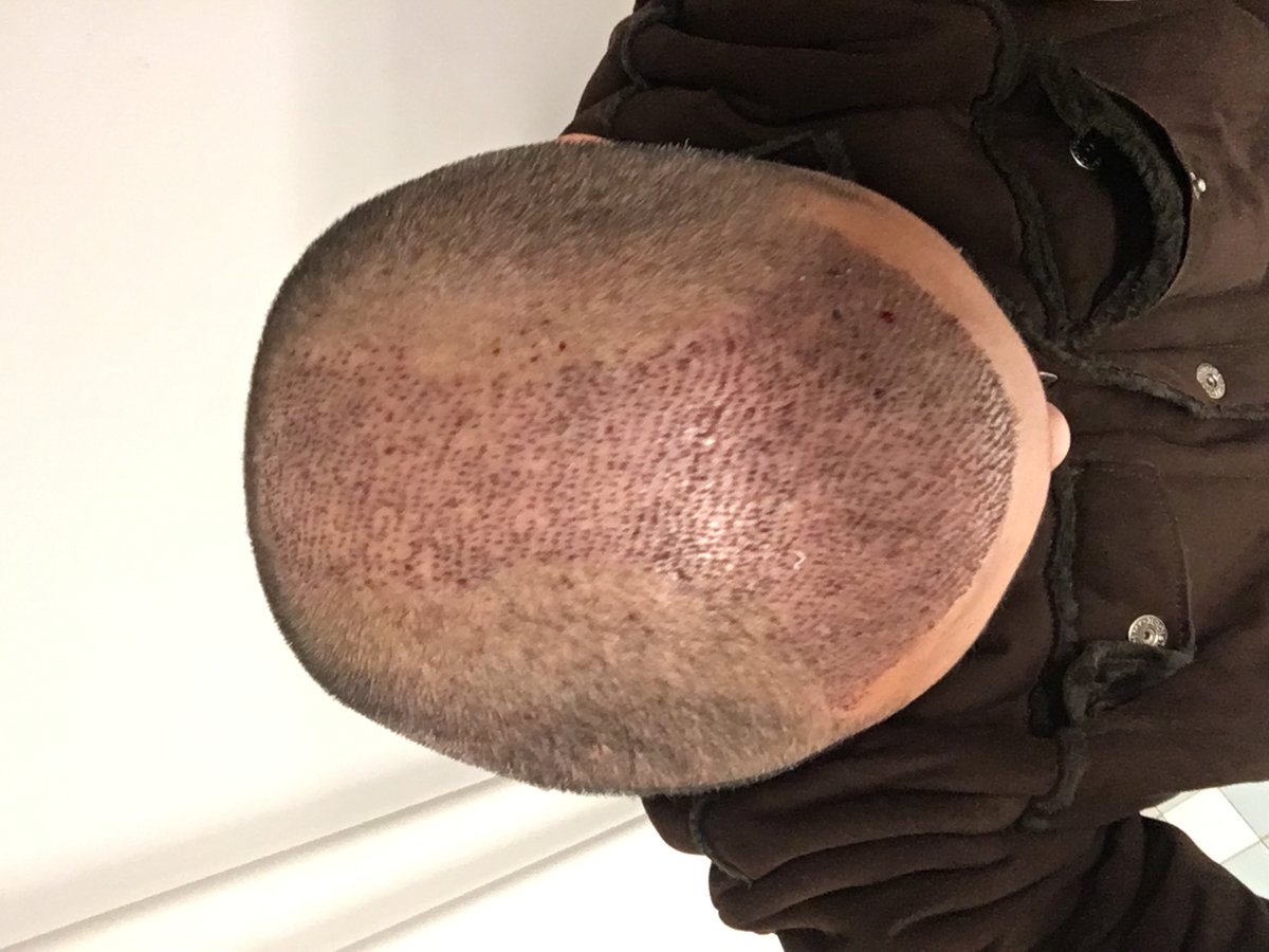 Dr. Yetkin BAYER - Dr. Yetkin BAYER