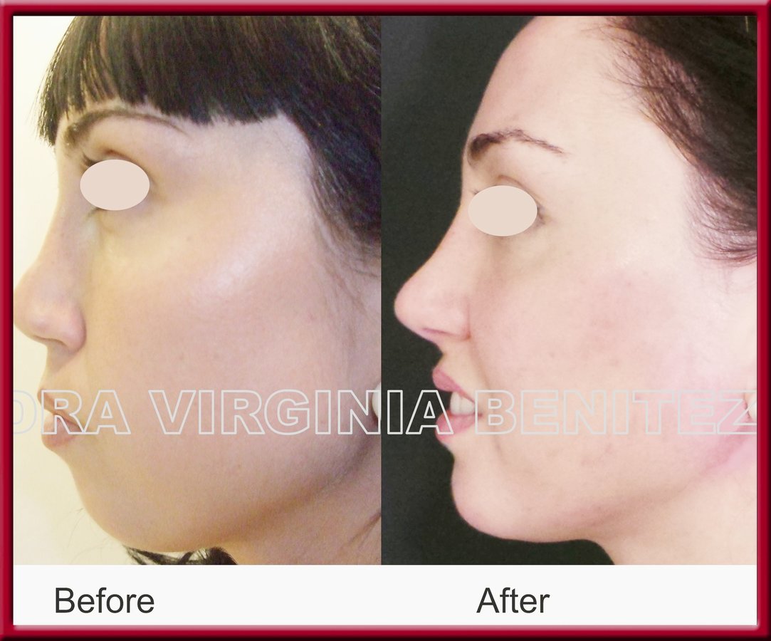 Dra. Virginia Benitez Roig - Marbella - Dra. Virginia Benitez Roig - Marbella