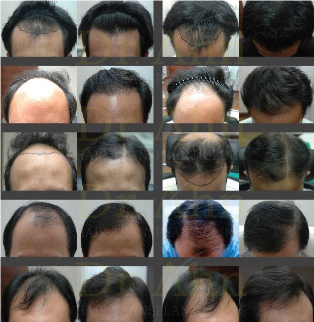 Dr.Ahn Hair Transplant Clinic - Dr.Ahn Hair Transplant Clinic