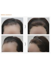 Dr.Ahn Hair Transplant Clinic - Dr.Ahn Hair Transplant Clinic