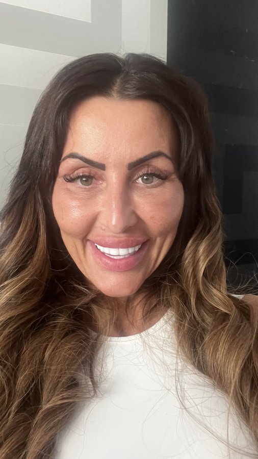 Dr.Emir Doğan - Oculoplastic Surgery - Dr.Emir Doğan - Oculoplastic Surgery