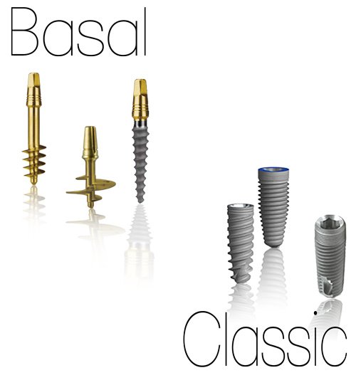 Dr.Motiwala Dental Clinic and Implant Center - Dr.Motiwala Dental Clinic and Implant Center