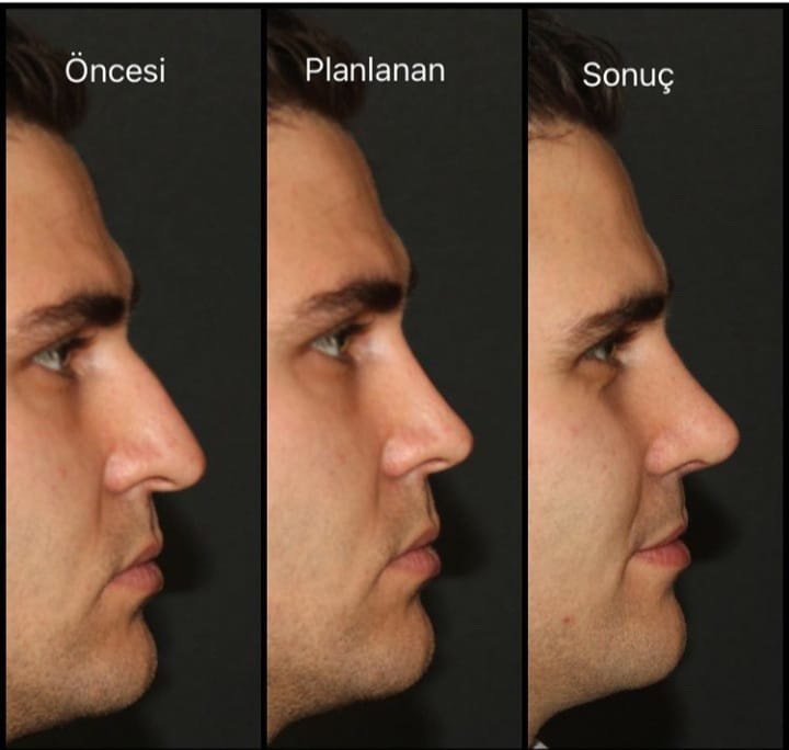 Dr.Serdar Ünlü - Dr.Serdar Ünlü