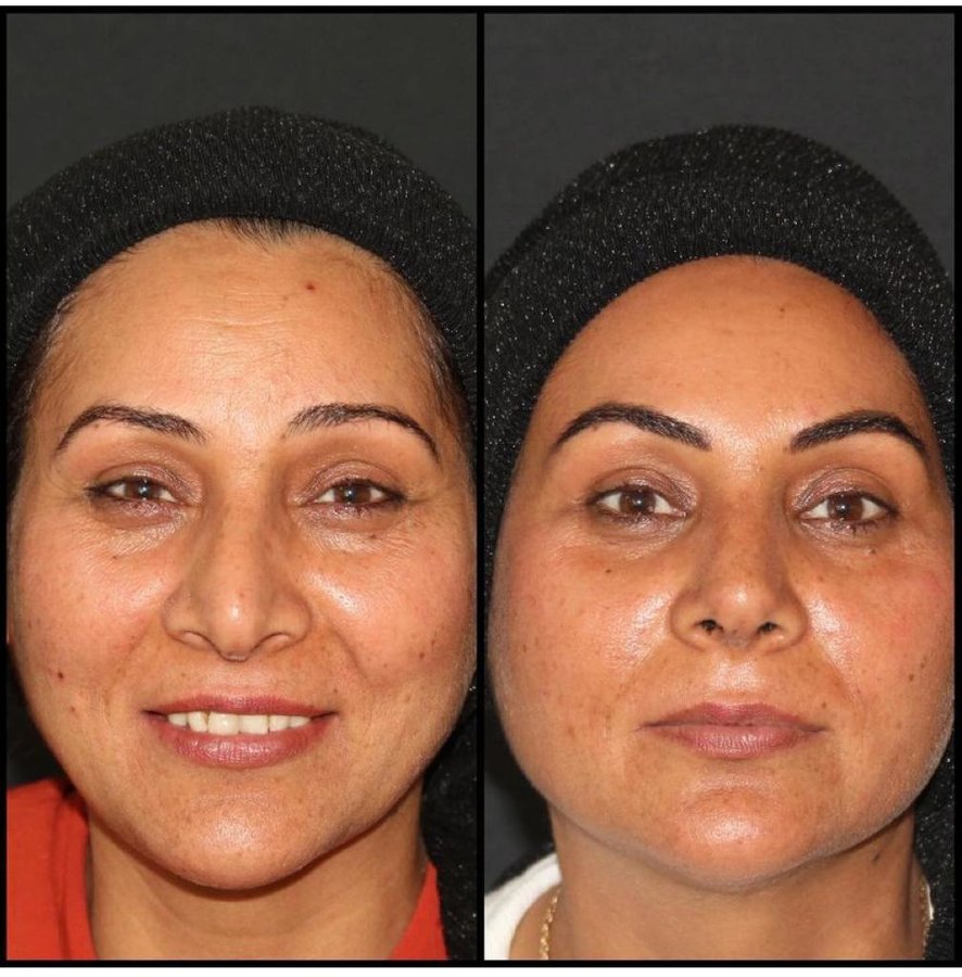 Dr.Serdar Ünlü - Dr.Serdar Ünlü