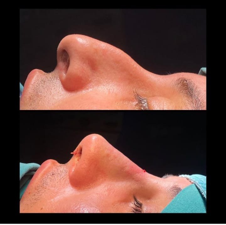 Dr.Serdar Ünlü - Dr.Serdar Ünlü