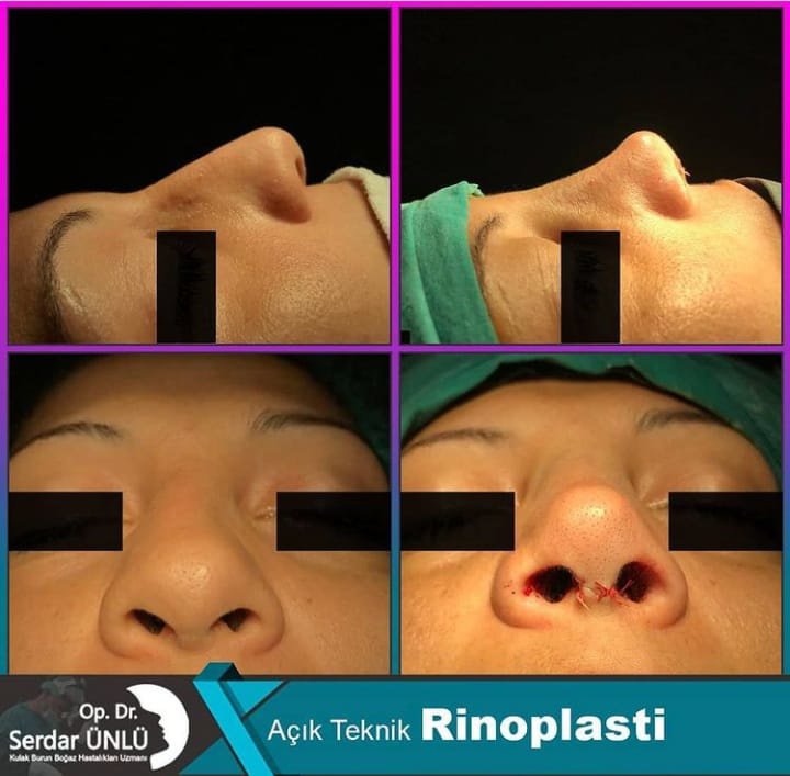 Dr.Serdar Ünlü - Dr.Serdar Ünlü