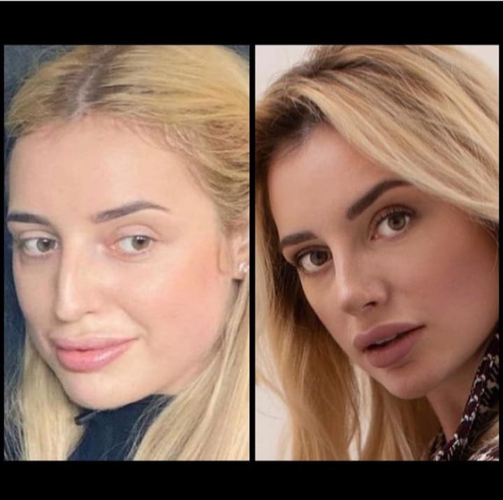 Dr.Serdar Ünlü - Dr.Serdar Ünlü