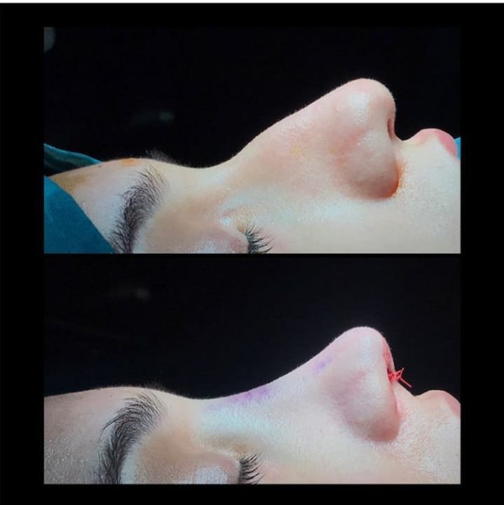 Dr.Serdar Ünlü - Dr.Serdar Ünlü