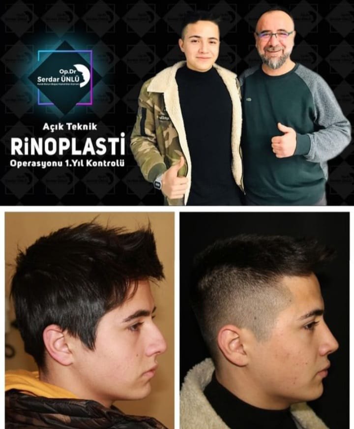 Dr.Serdar Ünlü - Dr.Serdar Ünlü