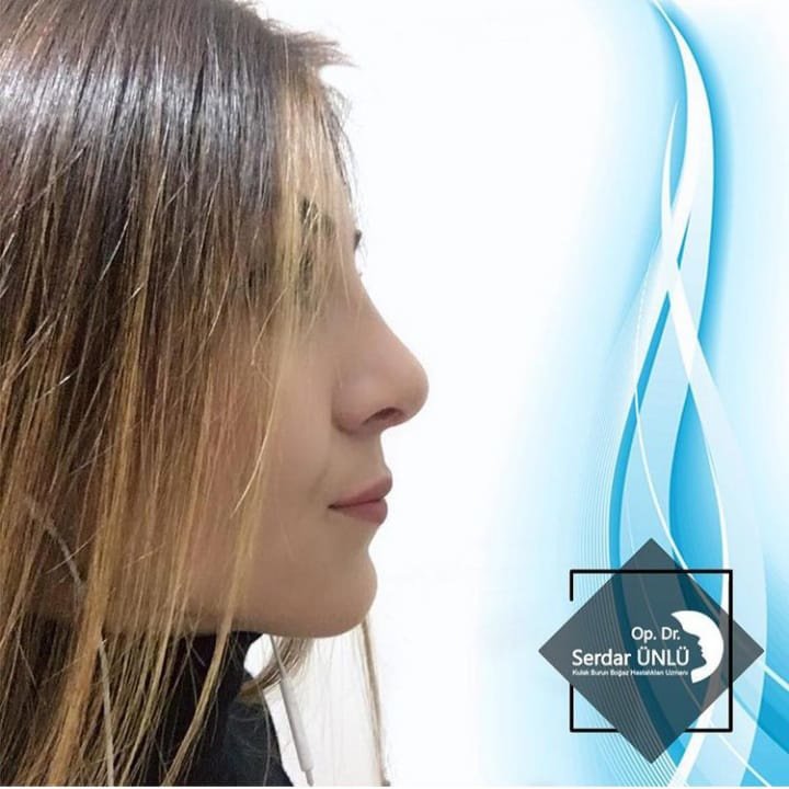 Dr.Serdar Ünlü - Dr.Serdar Ünlü