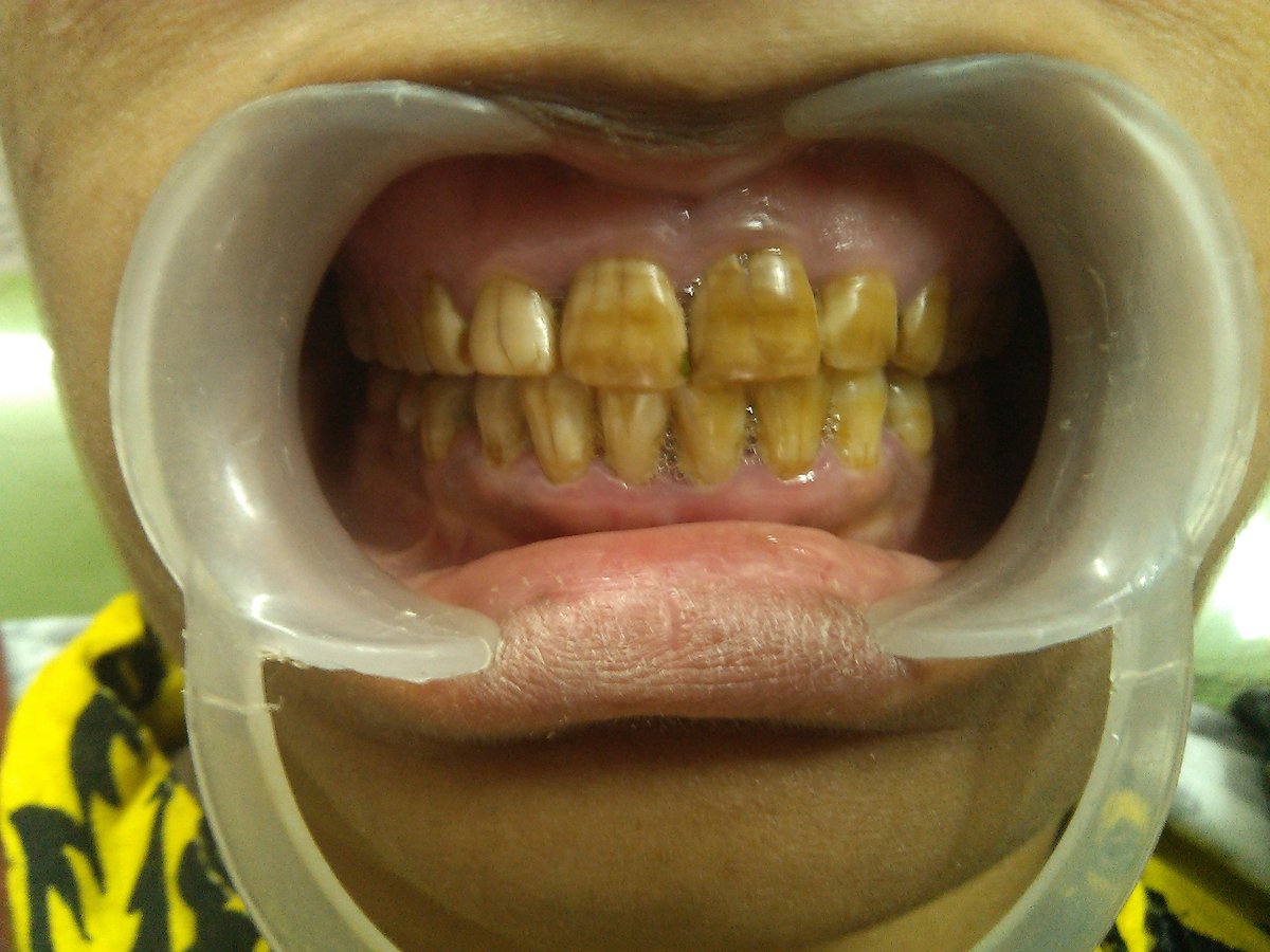 Dr.Sharma's Smile Signature: The Dental Clinic - Dr.Sharma's Smile Signature: The Dental Clinic