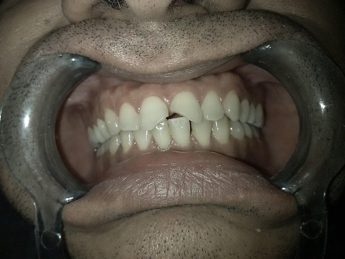 Dr.Sharma's Smile Signature: The Dental Clinic - Dr.Sharma's Smile Signature: The Dental Clinic