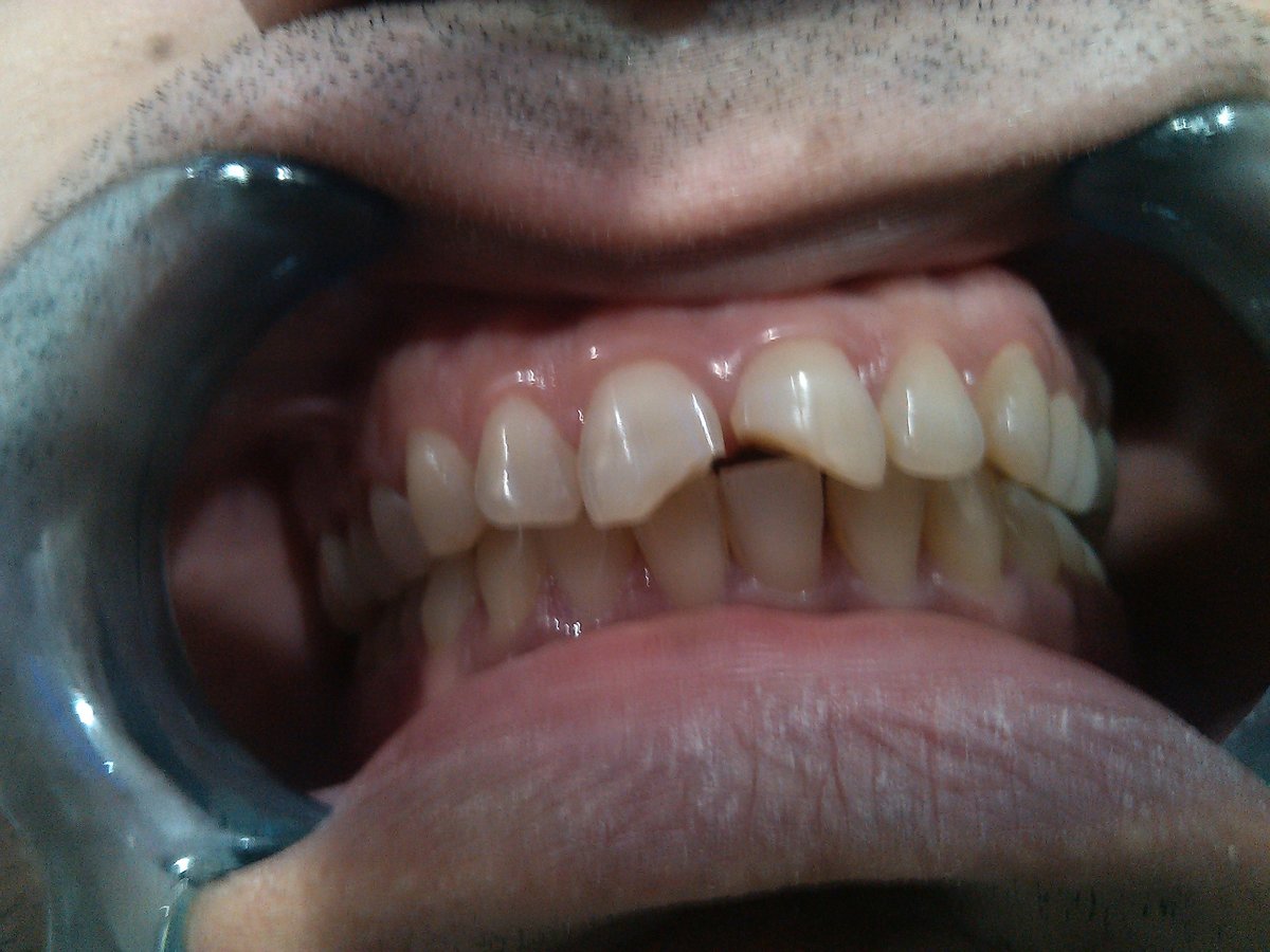 Dr.Sharma's Smile Signature: The Dental Clinic - Dr.Sharma's Smile Signature: The Dental Clinic