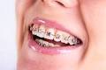 Dr.Sharma's Smile Signature: The Dental Clinic - Dr.Sharma's Smile Signature: The Dental Clinic
