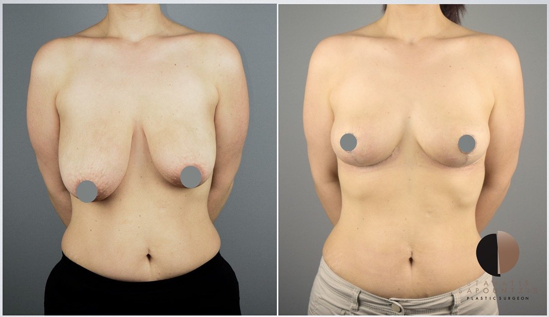 Dr.Stam Plastic Surgery - Dr.Stam Plastic Surgery