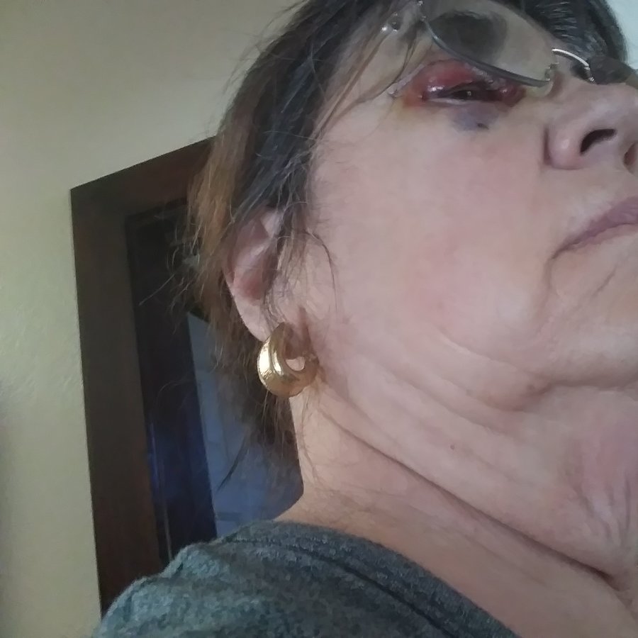 Dr.Stam Plastic Surgery - Dr.Stam Plastic Surgery