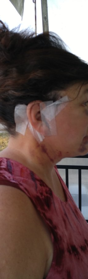 Dr.Stam Plastic Surgery - Dr.Stam Plastic Surgery