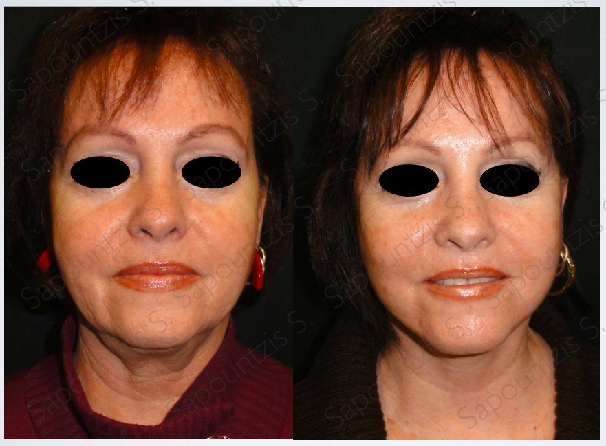 Dr.Stam Plastic Surgery - Dr.Stam Plastic Surgery