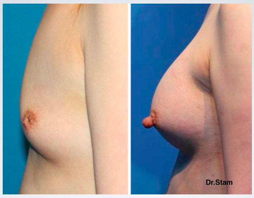 Dr.Stam Plastic Surgery - Dr.Stam Plastic Surgery