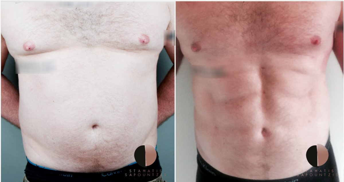 Dr.Stam Plastic Surgery - Dr.Stam Plastic Surgery