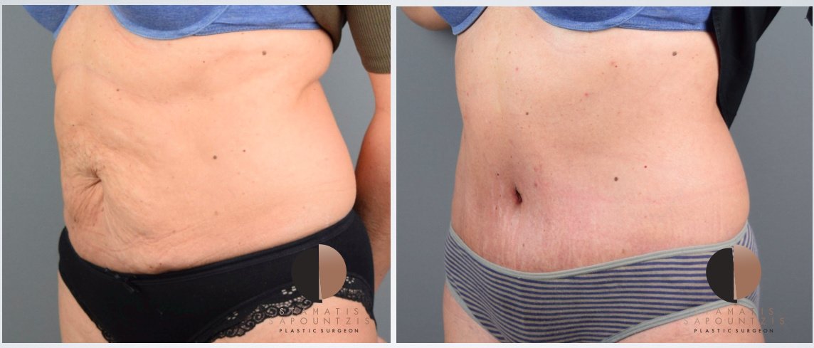 Dr.Stam Plastic Surgery - Dr.Stam Plastic Surgery