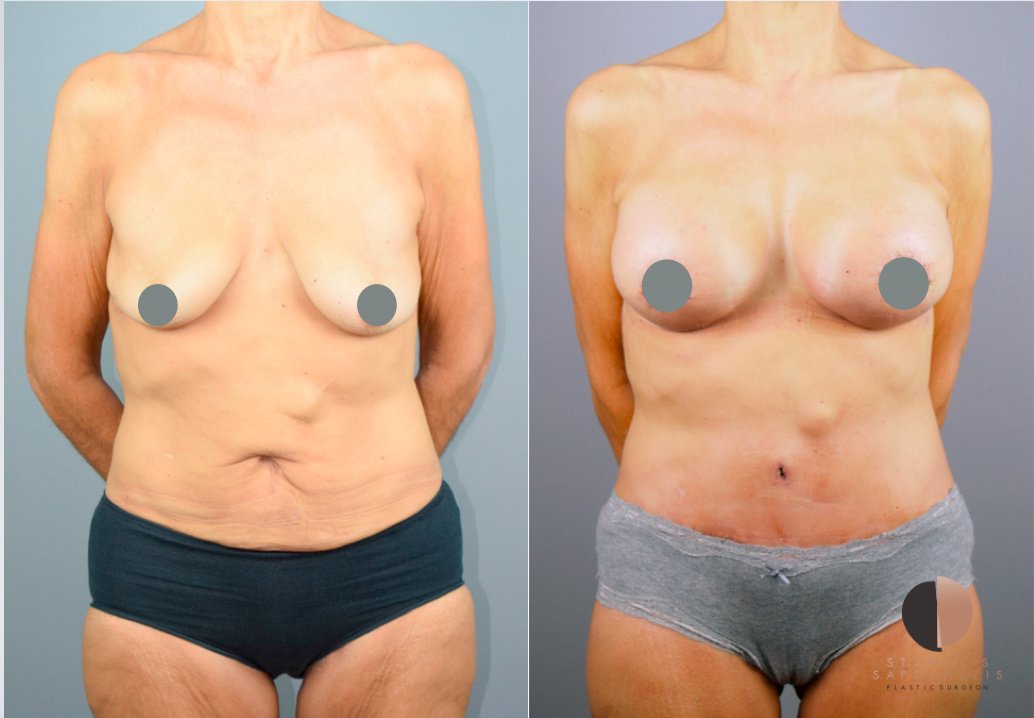 Dr.Stam Plastic Surgery - Dr.Stam Plastic Surgery