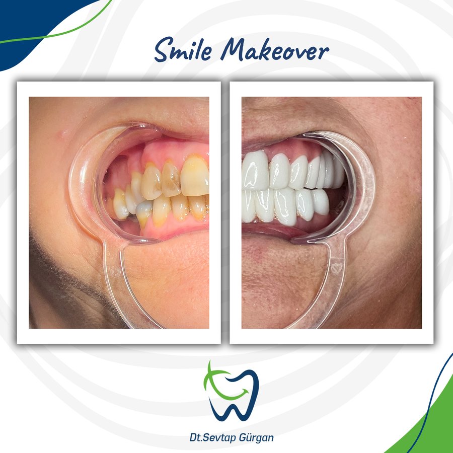 عيادة Dt. Sevtap Gurgan لطب الأسنان - Dt. Sevtap Gurgan Dental Clinic