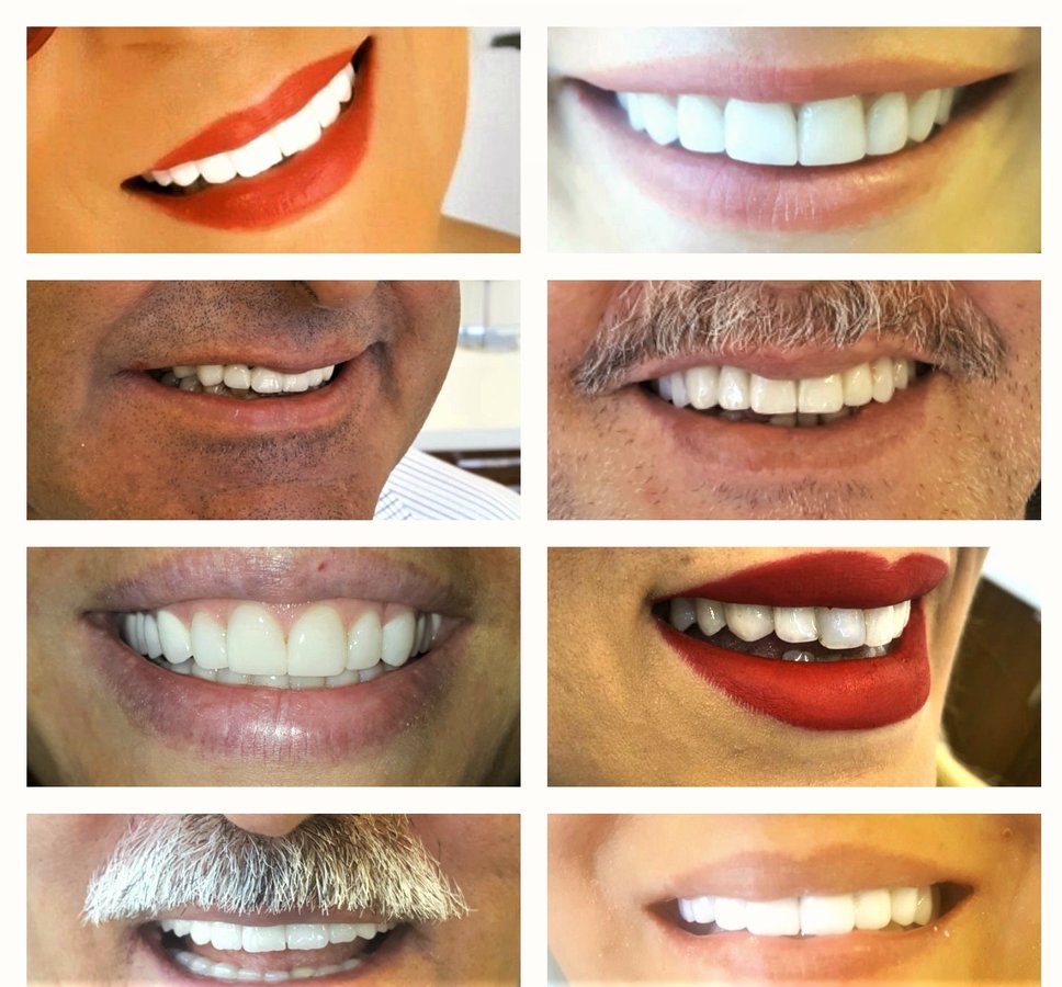 Dt.Anıl DORUK - Dt.Anıl DORUK