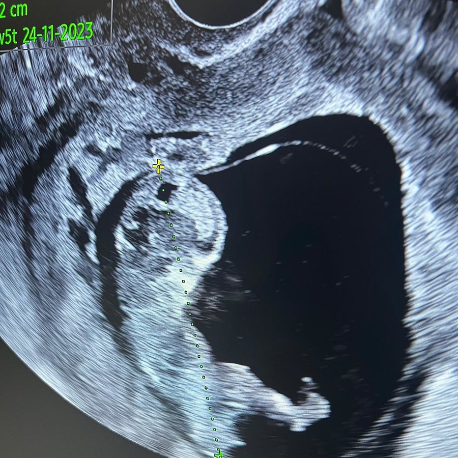 Dunya IVF Centre - Dunya IVF Centre