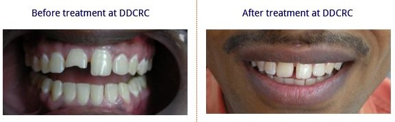 Durga Dental Care and Research Centre - Durga Dental Care and Research Centre