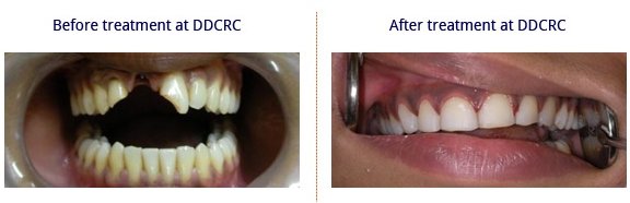 Durga Dental Care and Research Centre - Durga Dental Care and Research Centre
