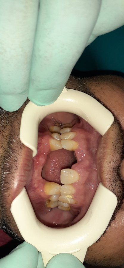 Eagle Dental Clinic (extreme makeovers) - Eagle Dental Clinic (extreme makeovers)