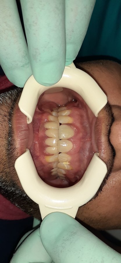 Eagle Dental Clinic (extreme makeovers) - Eagle Dental Clinic (extreme makeovers)