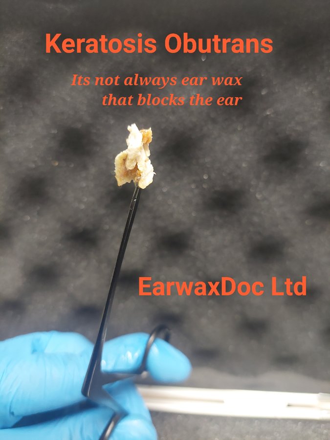EarwaxDoc Ltd - Ear Wax Removal Microsuction W'ton - EarwaxDoc Ltd - Ear Wax Removal Microsuction W'ton