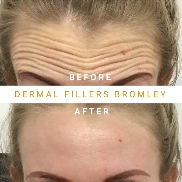 Eason جماليات - Eason Aesthetics