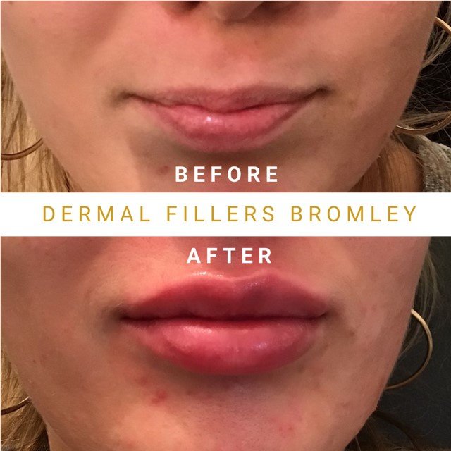 Eason جماليات - Eason Aesthetics