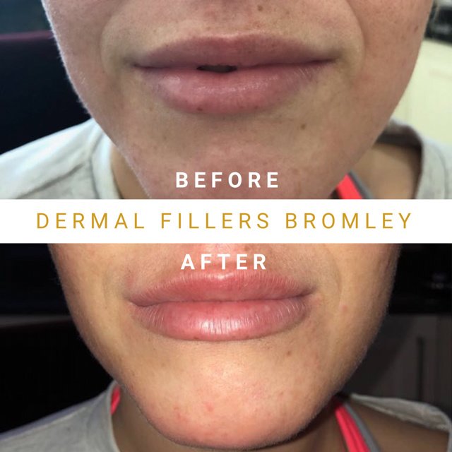 Eason جماليات - Eason Aesthetics